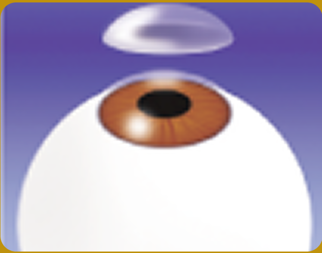 Place Soft Contact Lens