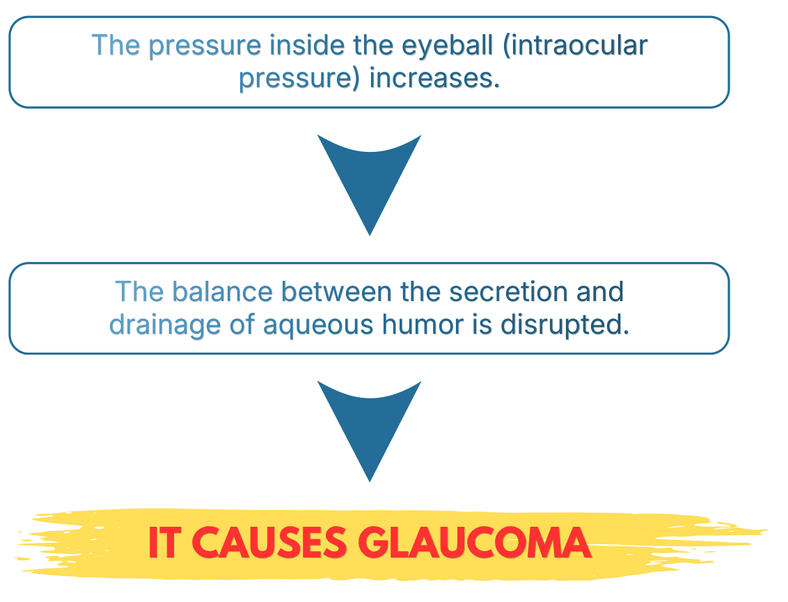 Aqueous humor imbalance causes glaucoma