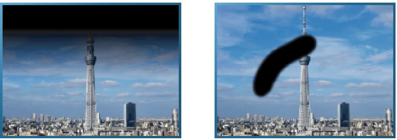 Visual field constriction and visual field defect