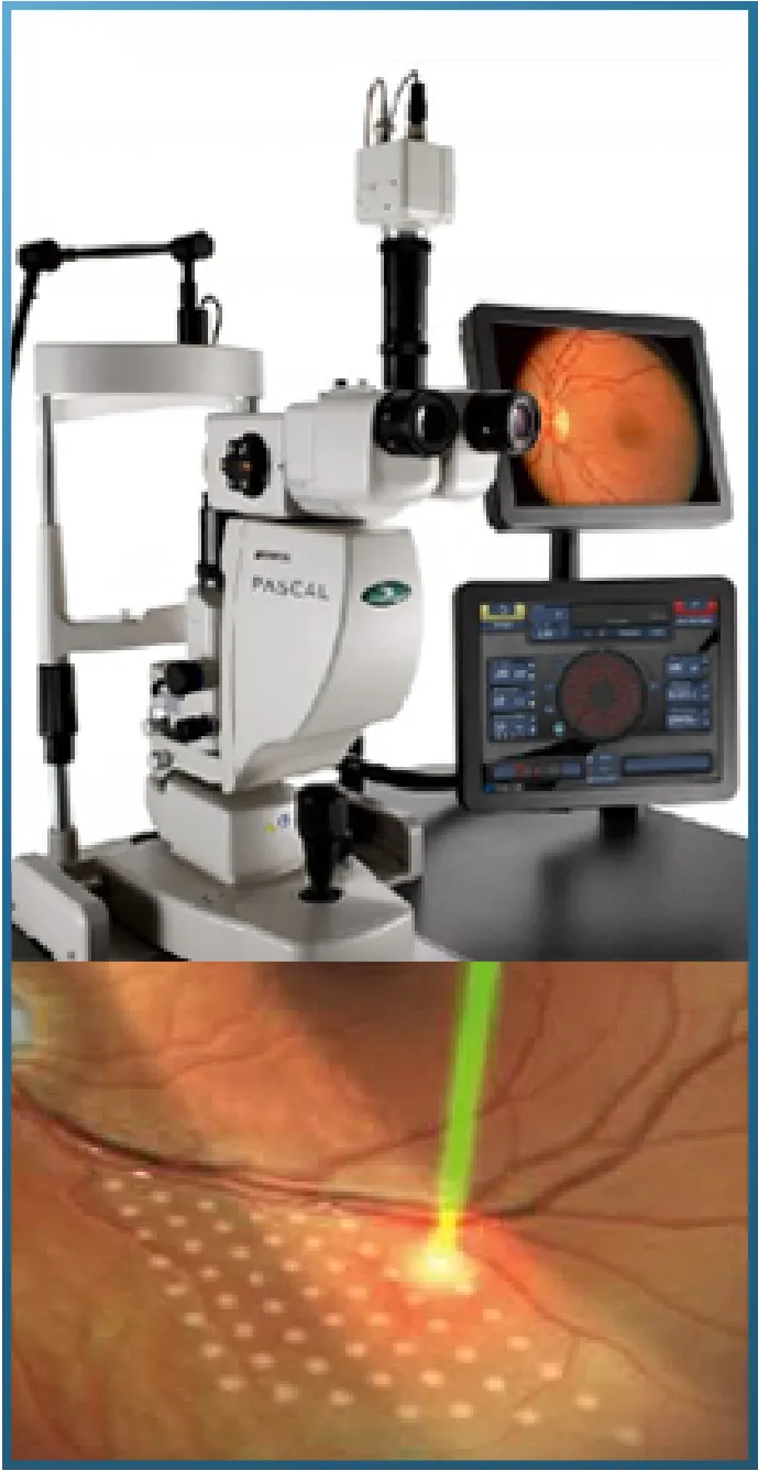 PASCAL Synthesis laser